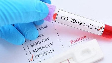 Virus COVID-19 Baru Asal Indonesia, Namanya Varian B.1466.2, WHO Memantau