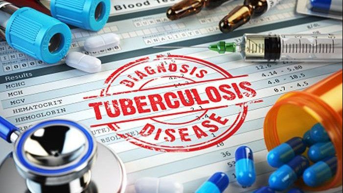 Indonesia Urutan Ketiga Negara dengan Penderita TB Terbanyak, Berikut Penyebab dan Pencegahan Penyakit Ini