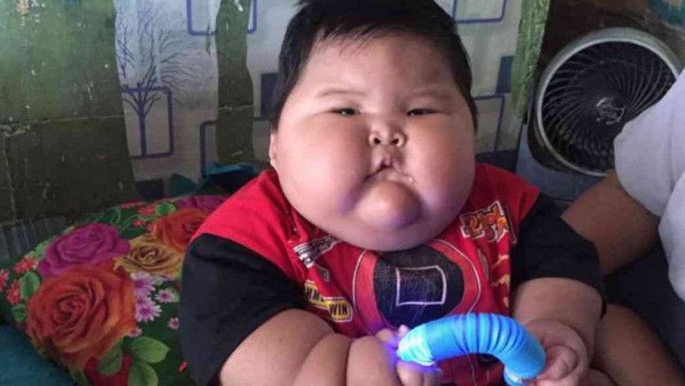 Berbagai Bahaya Obesitas pada Bayi yang Harus Diwaspadai