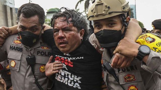 'Memprihatinkan', Kondisi Terkini Ade Armando Usai Dikeroyok Massa Demo 11 April, Kapolda Metro: Luka di Kepala