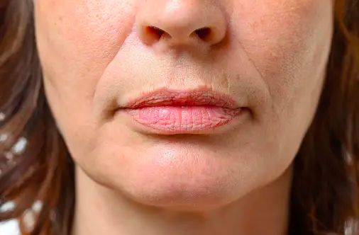 4 Cara Sederhana Mencegah Keriput di Bibir Muncul Lebih Cepat