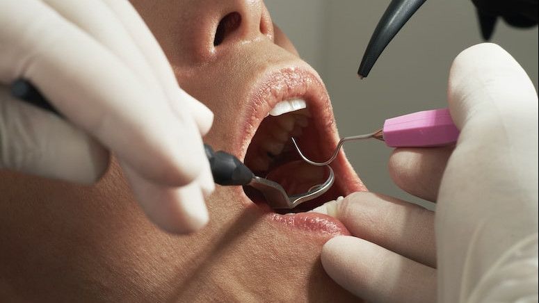 Jenis Sakit Gigi yang Umum Terjadi Berdasarkan Penyebabnya