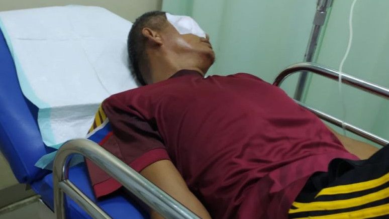 Tak Terima Anaknya Ditegur Karena Merokok di Sekolah, Orang Tua Murid Aniaya Guru di Bengkulu hingga Nyaris Buta