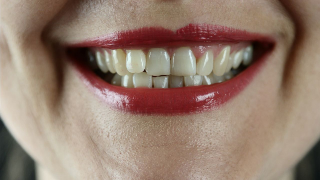 Waktu yang Tepat Cabut Gigi Bungsu Alasan Mengapa Perlu Mencabut
