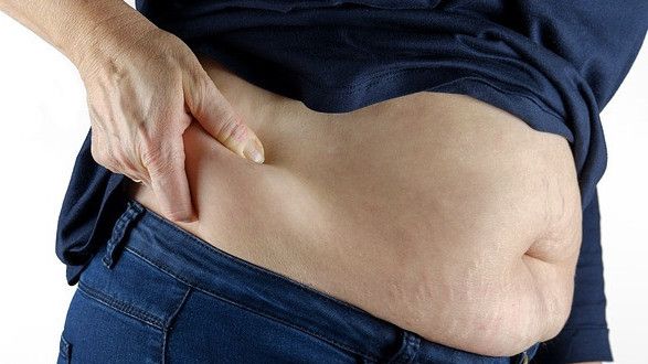 Sedot Lemak Bukan Upaya Menurunkan Berat Badan, Begini Penjelasan Medisnya