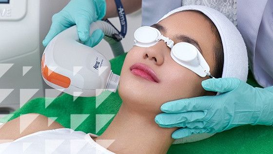 Manfaat Sensasi Treatment Alma Beauty Rejuvenation, Memutihkan Sekaligus Menyehatkan Kulit Wajah