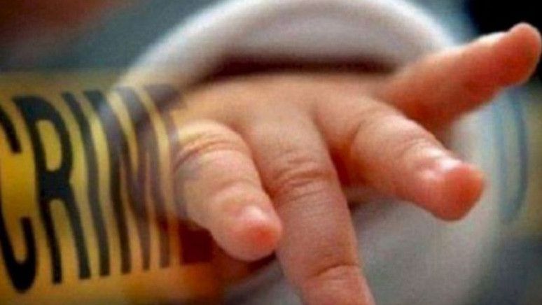 Kasus Amputasi Tangan Kanan Bayi Arumi di Bima NTB Ada Dugaan Malapraktik, 89 Nakes Diperika