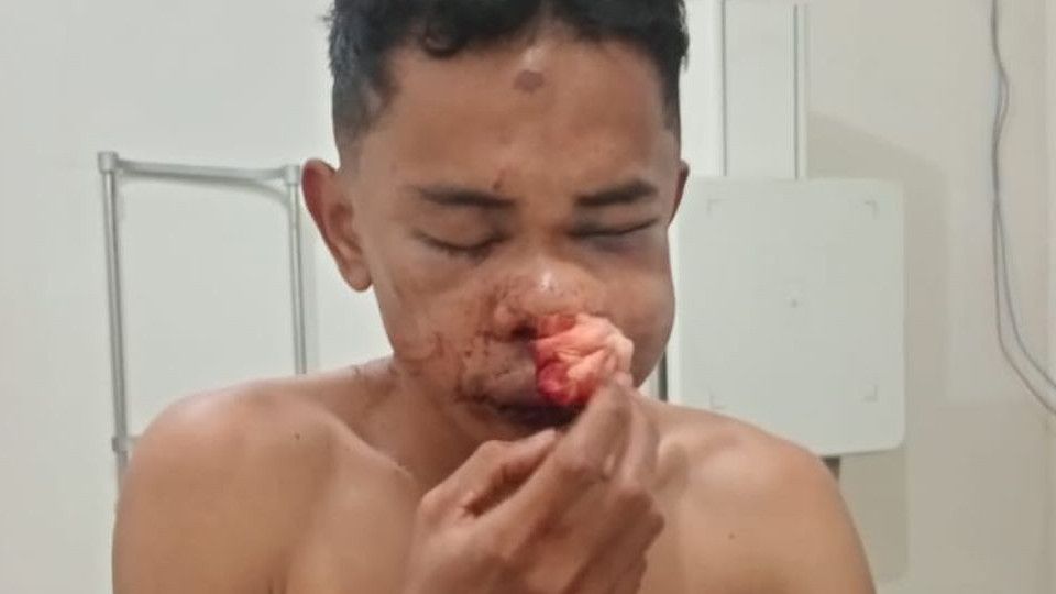 Empat Polisi di NTT Terancam Kariernya Usai Keroyok Pemuda dalam Polres Manggarai