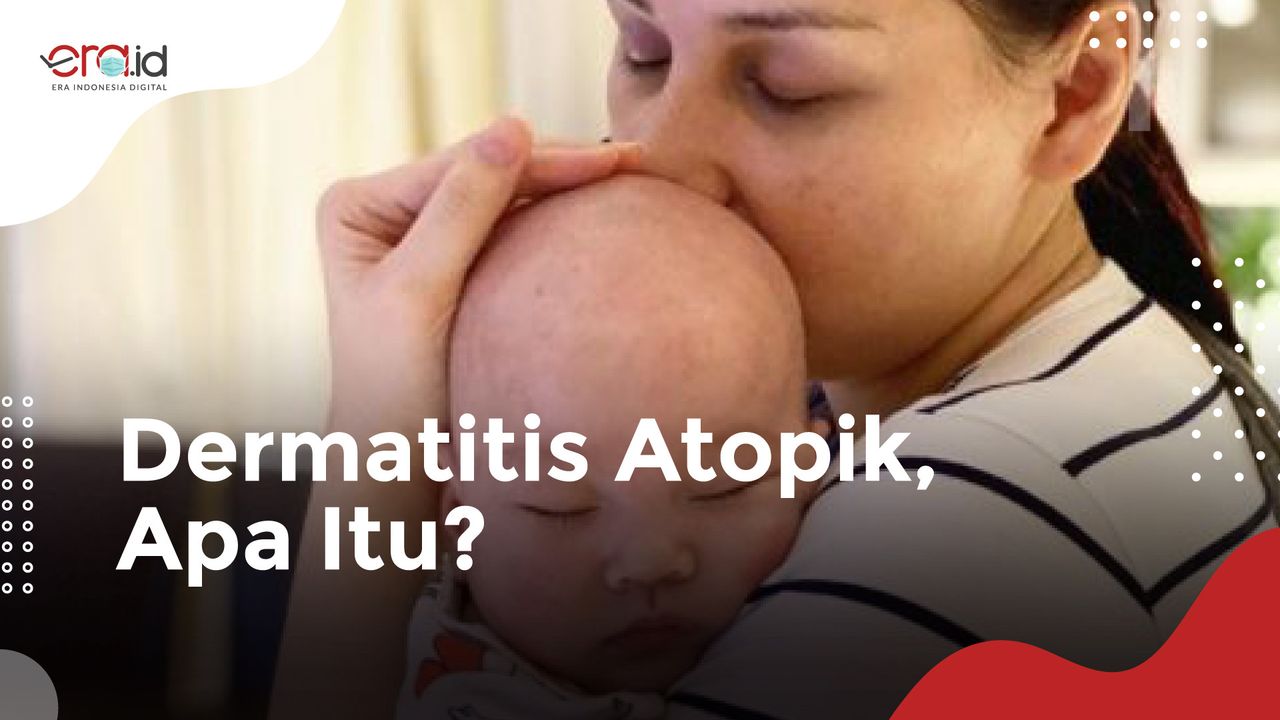 Anak Mona Ratuliu Mengidap Penyakit Dermatitis Atopik, Apa itu?