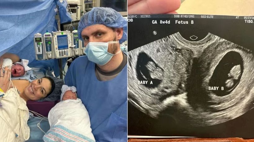 Ibu Pemilik Dua Rahim Melahirkan Bayi Kembar di AS, Kejadian Langka Satu Banding Sejuta