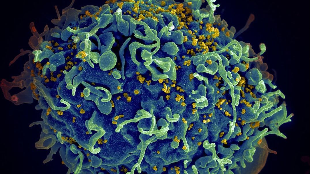 Kasus HIV/AIDS di Solo Meningkat, KPA Solo Antisipasi Penderita Kabur dan Menghilang