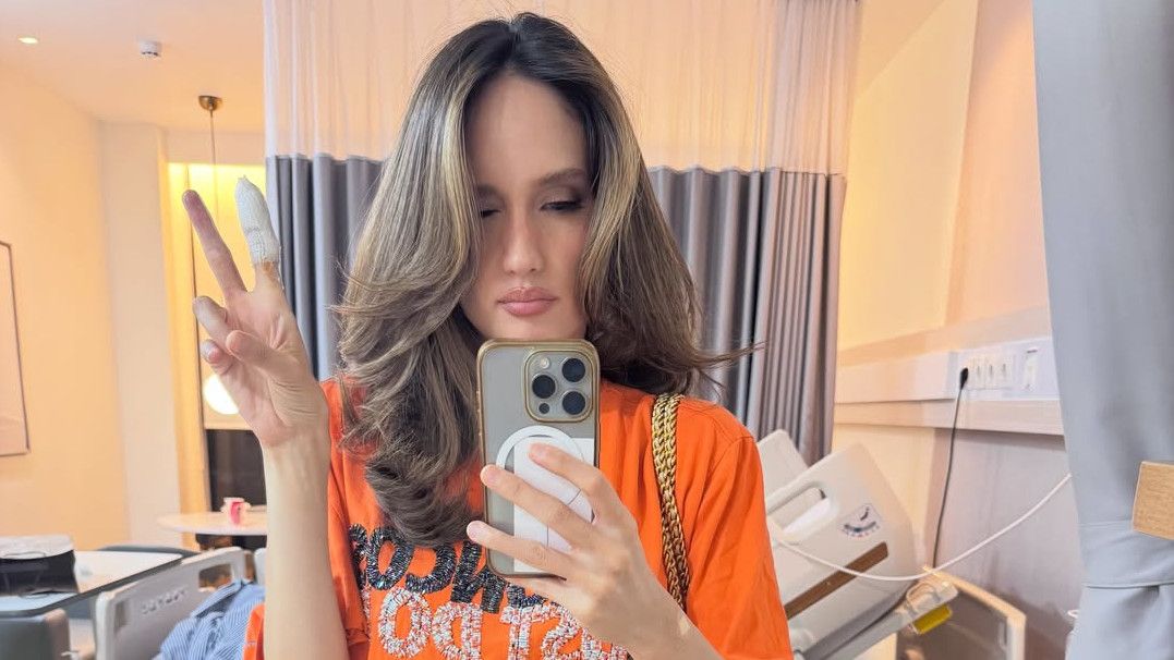 Heboh Jari Kena Sayatan Pisau hingga Dicap Berlebihan, Cinta Laura Bilang Begini