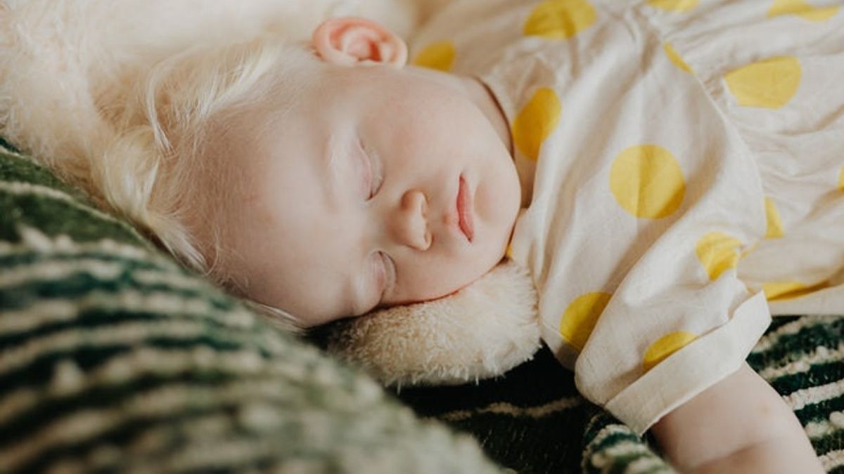 Ketahui Penyebab Penyakit Kuning pada Bayi yang Baru Lahir, Begini Prosesnya