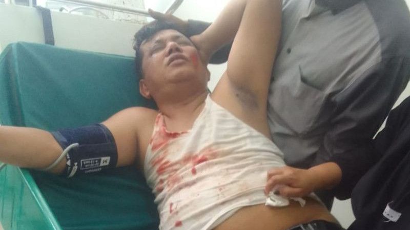 Seorang Kepala Desa di Bekasi Terluka Parah Ditimpa Baliho Caleg dari Gerindra, Kasihan
