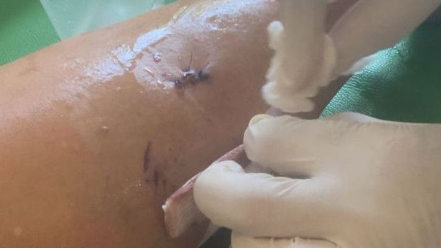 Lansia di Riau Diserang Anjing Saat Duduk Santai di Atas Motor, Ngeri