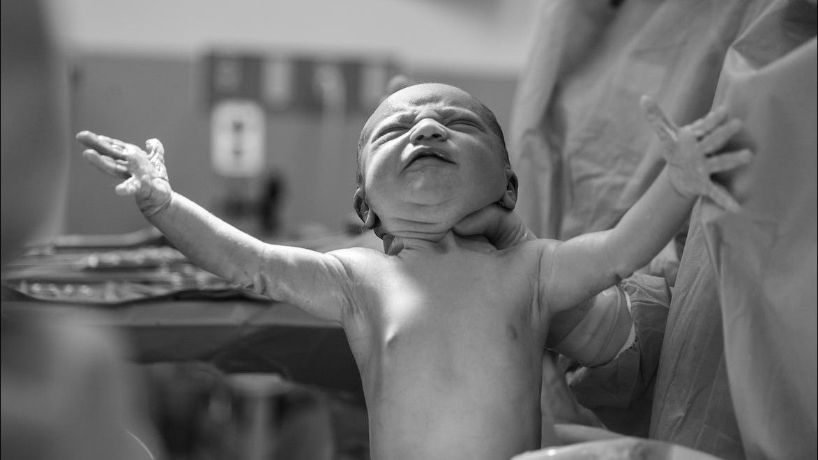 Asfiksia Neonatorum pada Bayi Baru Lahir, Apa Gejala dan Penyebabnya?
