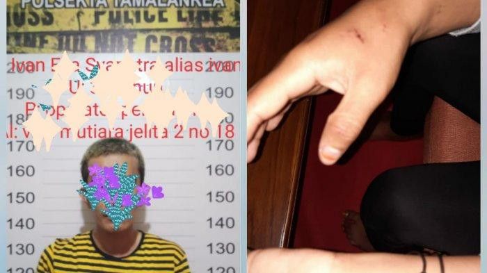 Gigit Mantan Pacar, Pria di Makassar Ini Dilaporkan ke Polisi