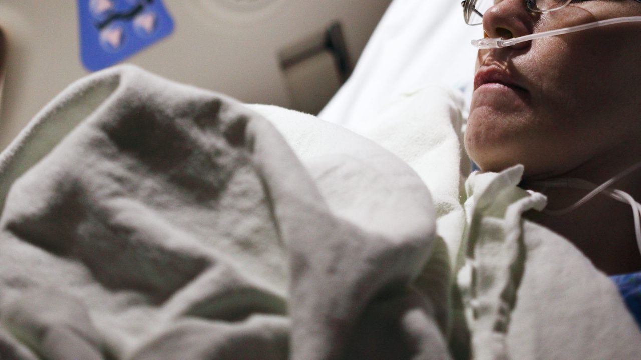 Pejabat RSJ Kalbar Disiram Air Keras, Wajahnya Melepuh, Apa Pemicunya?