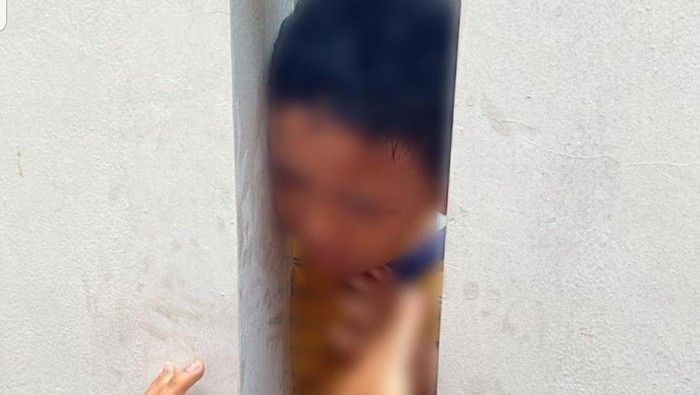 Kepala Seorang Anak di Kota Bekasi Terjepit Tembok, Untung Diselamatkan Damkar