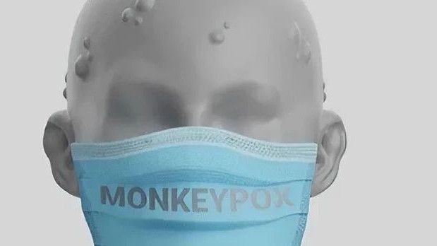 Suspek Cacar Monyet di Makassar Bertambah, Masih Tunggu Hasil Lab dari Jakarta