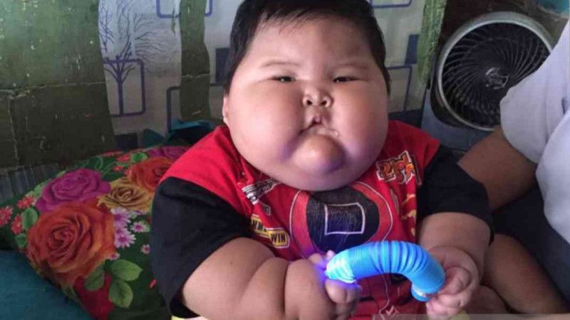 Sempat Viral karena Alami Obesitas, Balita 16 Bulan Berbobot 26,9 Kg di Bekasi Jalani Rawat Jalan Intensif