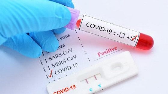 Terungkap! Bio Farma Beberkan Biaya Tes PCR Covid-19, Ambil Untung 10 Persen