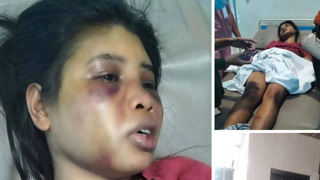 Viral Majikan di Batam Pukuli ART dan Menyuruhnya Makan Kotoran Anjing