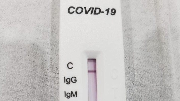 Info Penting! Hasil Rapid Tes Antigen Kini Sama dengan Tes PCR, Ini Penjelasannya
