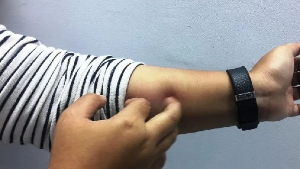 Gatal-Gatal karena Stres? Ini Cara Mengatasinya!