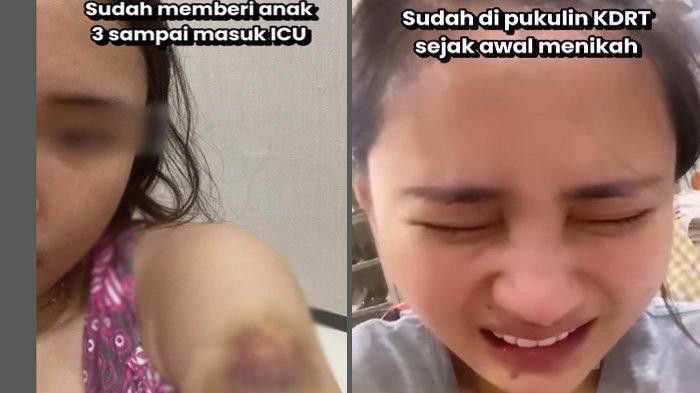 Viral Video Perempuan Korban KDRT, Diduga Suami Sudah Tersangka tapi Belum Ditahan