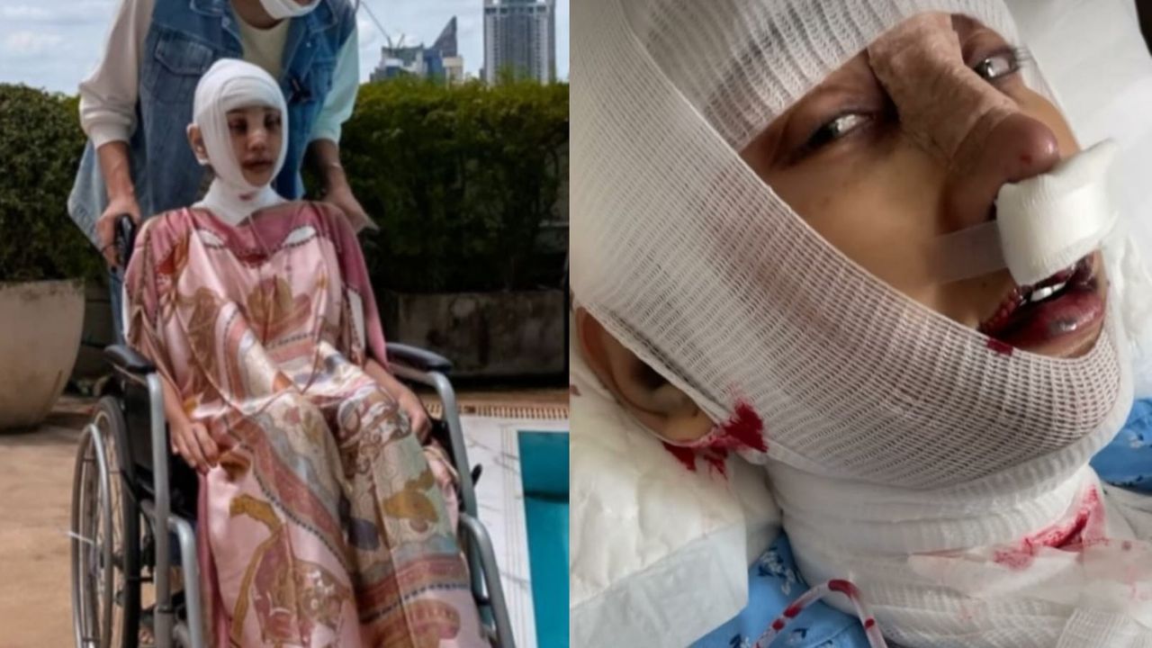 Lucinta Luna Beberkan Kondisi Terbaru Pasca Operasi Potong Leher Demi Hilangkan Jakun, Netizen: Kayak Zombi!
