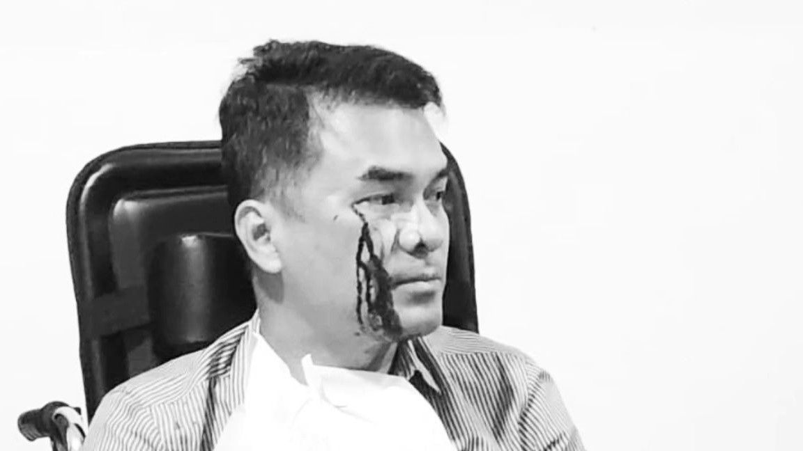 Dulu Ade Armando Dikeroyok, Kini Bro Ron Kader PSI yang Dipukuli hingga Viral, Pilu