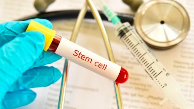 Cara Memilih Stem Cell yang Tepat untuk Terapi agar Tidak Memicu Kerusakan Organ