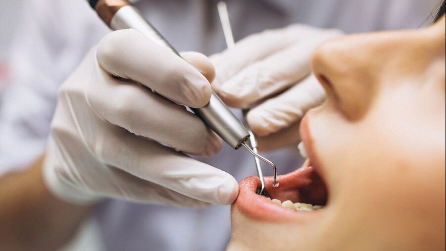 Biaya Cabut Gigi hingga Jutaan, Apakah Bisa Ditanggung BPJS Kesehatan?