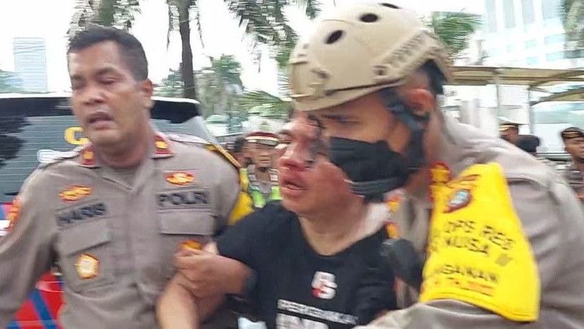 Kapolda Metro Jaya Ungkap Kondisi Terkini Ade Armando Usai Dikeroyok di DPR: Alami Cedera Serius di Kepala
