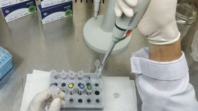 RT-LAMP Jadi Alternatif Deteksi COVID-19, Akurasi Dapat Ditingkatkan Setara PCR