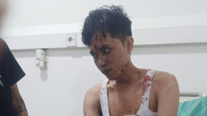 Ngeri! Kepala Seorang Pria Dihantam Palu Bolak-Balik Saat Nongkrong di Bandung