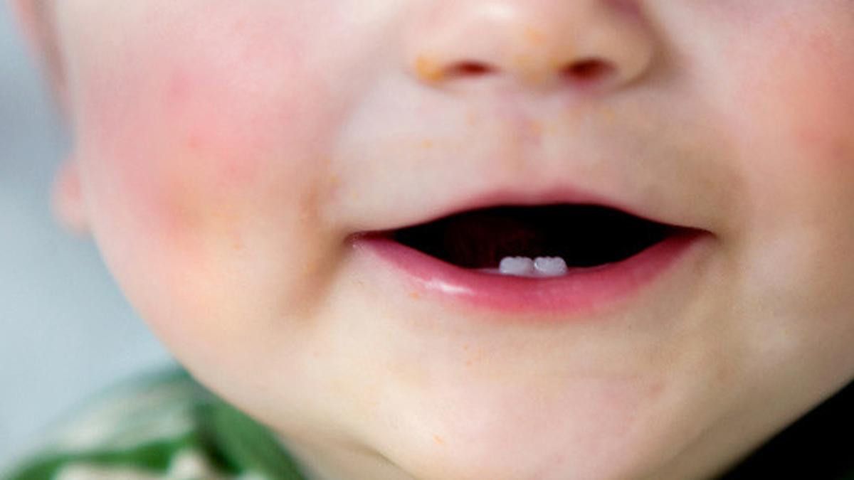 Apa Penyebab Gigi Anak Terlambat Tumbuh? Simak Penjelasan Berikut
