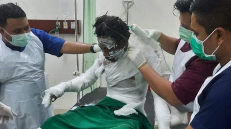 Tragis, Gerobak Bakso Goreng Meledak dan Lukai 9 Orang di Aceh Timur