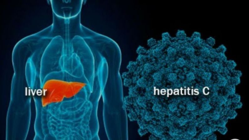 Warga RI Waspada! Hepatitis Akut Diduga Penyebab 3 Anak di Jakarta Meninggal Dunia